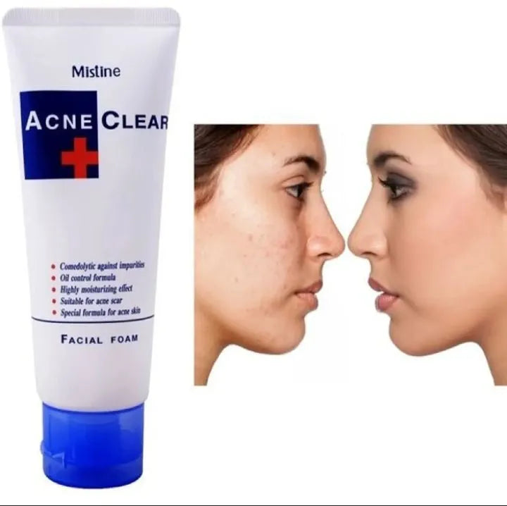 Mistine Acne Clear Facial Foam Face Wash 85g